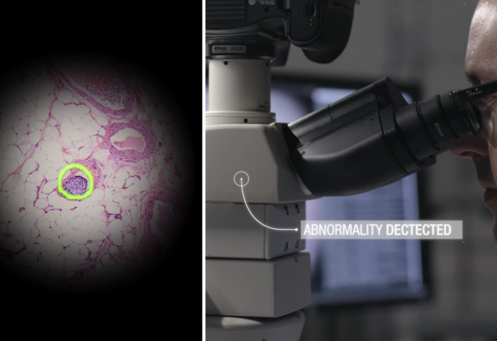 Un microscope AR pour détecter les cancers