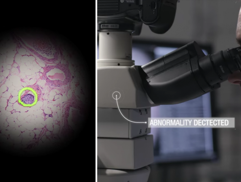 Un microscope AR pour détecter les cancers